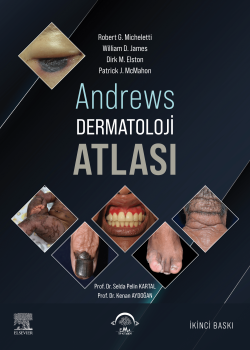 Andrews Dermatoloji Atlası