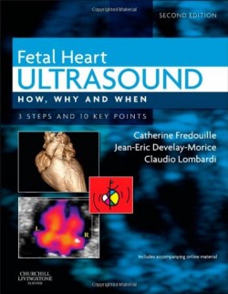 Fetal Heart Ultrasound