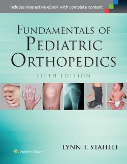 Fundamentals of Pediatric Orthopedics, 5e