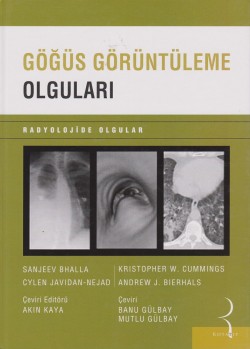 Göğüs Görüntüleme Olguları