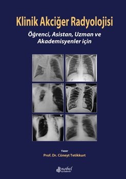 Klinik Akciğer Radyolojisi: Öğrenci, Asistan, Uzman ve Akademisyenler için