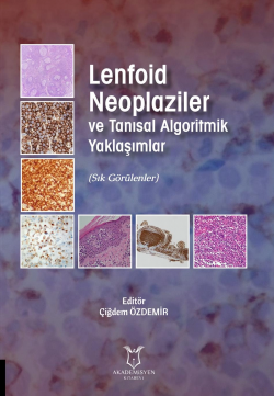 Lenfoid Neoplaziler ve Tanısal Algoritmik Yaklaşımlar