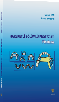 Hareketli Bölümlü Protezler Planlama