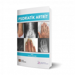 Psoriatik Artrit