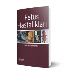 Fetus Hastalıkları